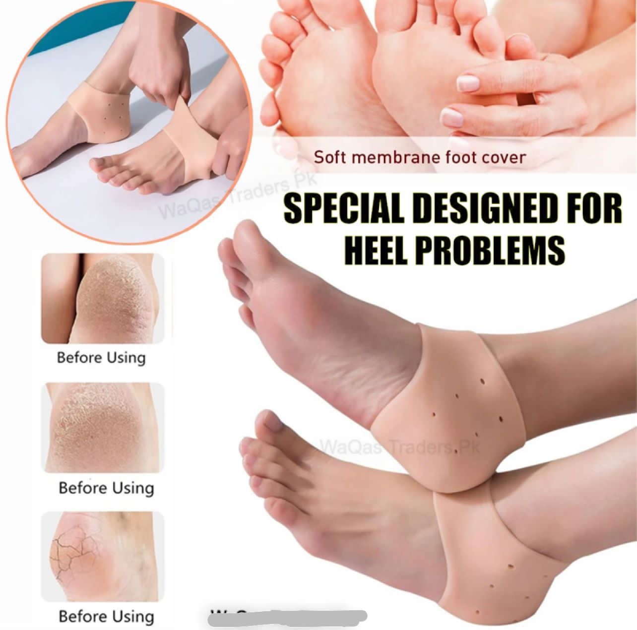 Silicone Heel Pain Relief Set β Anti-Crack Unisex Heel Cushions