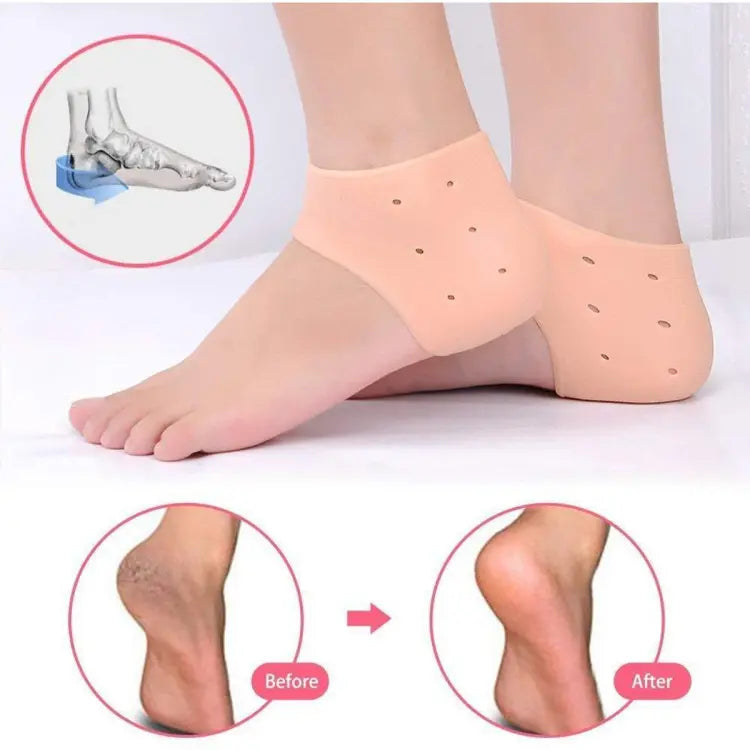 Silicone Heel Pain Relief Set – Anti-Crack Unisex Heel Cushions